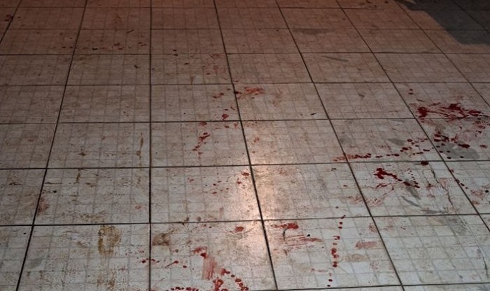 Desentendimento em jogo de futebol não termina bem