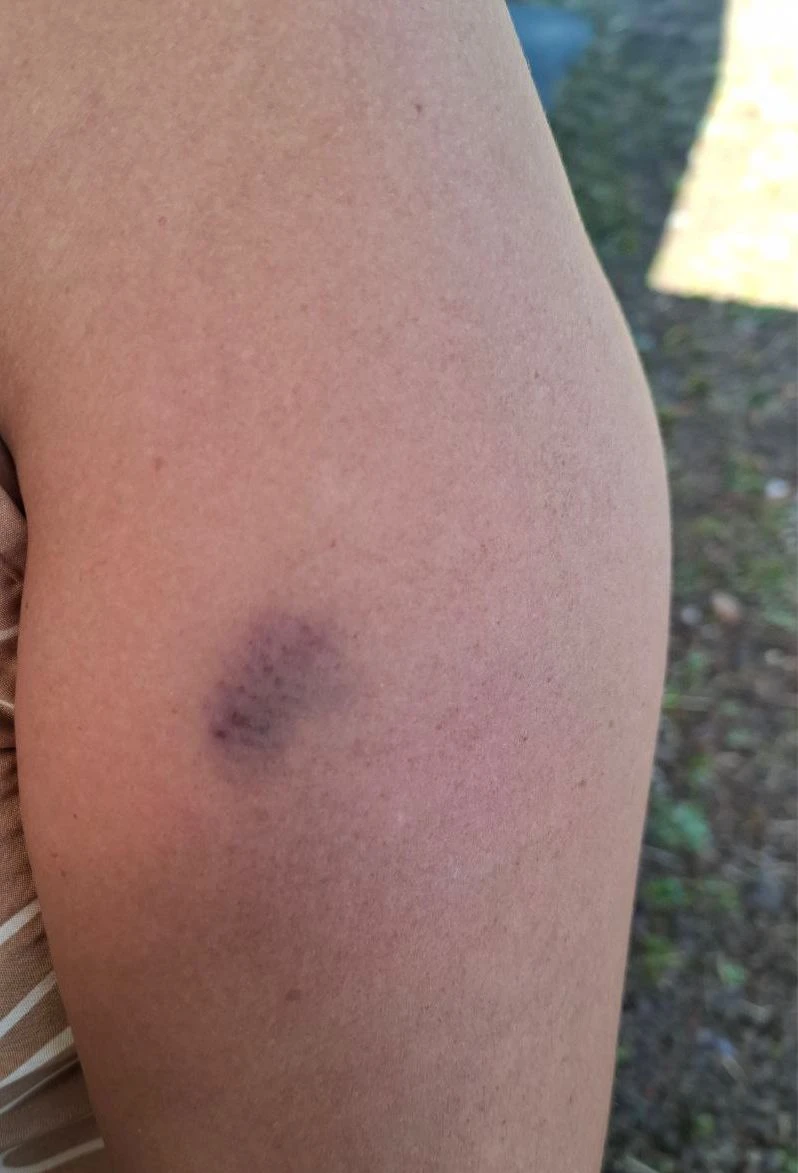 Mãe denuncia agressões da filha de 14 anos em Águas de Chapecó