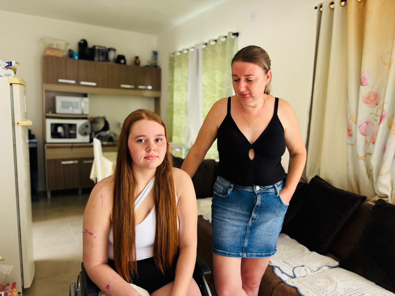 Após conquistar CNH, jovem perde a perna com moto nova