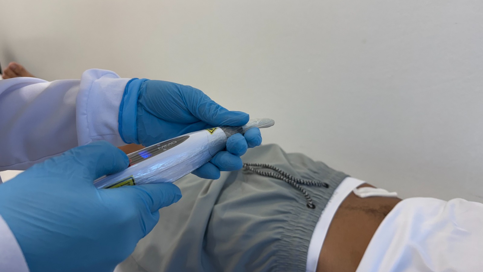 Prefeitura adota laserterapia e acelera tratamento de feridas na rede pública