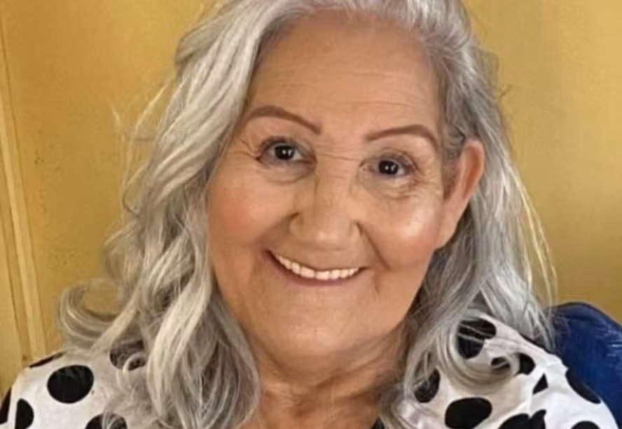 Morre mulher que teve o rosto desfigurado pelo ex-marido