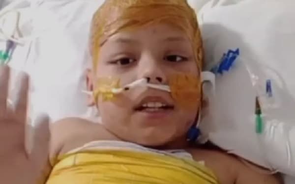 Garoto sobrevive a choque de 25 mil volts
