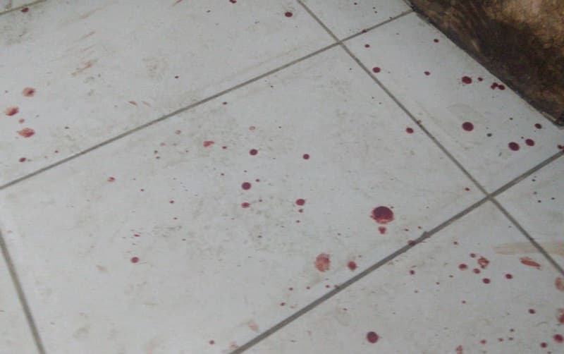 Vítima ouviu chamado de conhecido e foi baleado em União do Oeste (Foto: Ilustração)