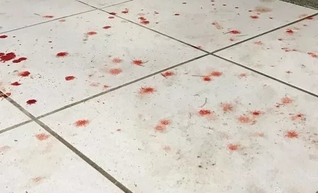 Vítima teve ferimentos graves (Foto: Ilustração)
