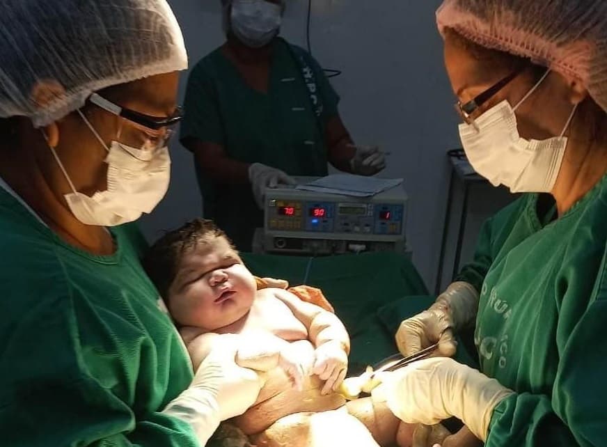 'Bebê gigante,' Angerson Santos, nasceu com mais de 7kg (Foto: Hospital Padre Colombo)