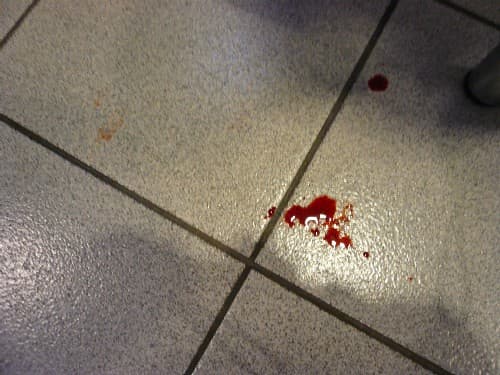 Vítima foi levada para o hospital após levar facada (Foto: Ilustração)