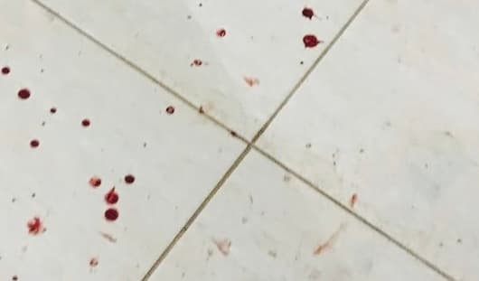 Morador morre após agressão em Pinhalzinho