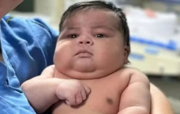 Recém-nascido vem ao mundo pesando mais de 6 quilos