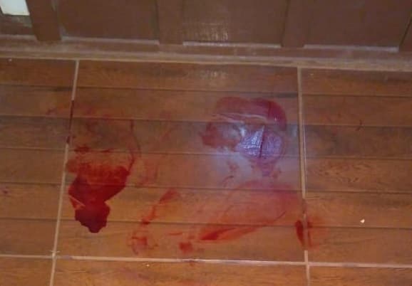 Mulher nega ter relação sexual e tem lábio cortado