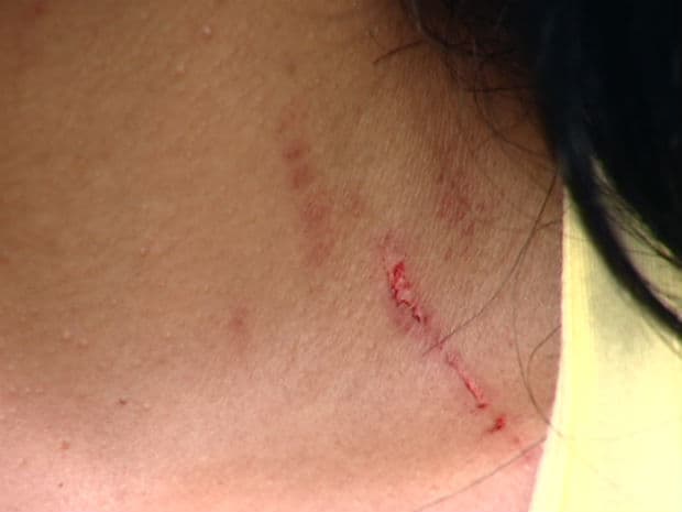 Desentendimento terminou em agressões (Foto: Ilustração)
