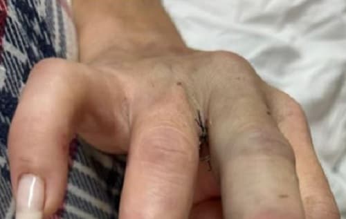 Vítima teve graves ferimentos (Foto: Divulgação)