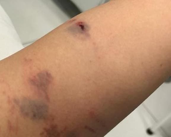 Bofetões, tabefes: Irmãs brigam ‘pra valer’ em São Carlos