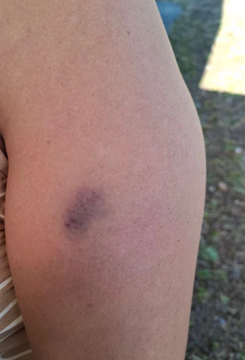 Mãe denuncia agressões da filha de 14 anos em Águas de Chapecó