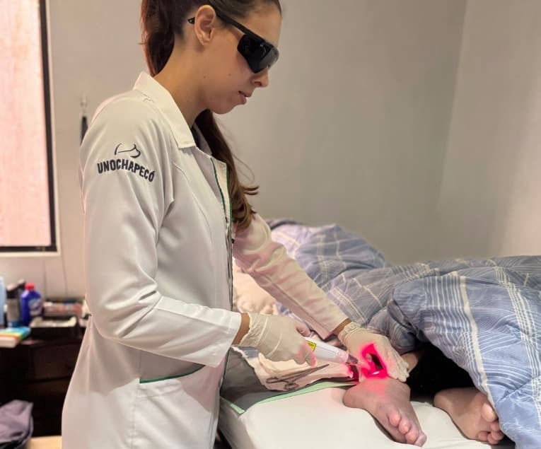 Modelo implanta laser terapia para ampliar tratamento de feridas crônicas na rede pública de saúde