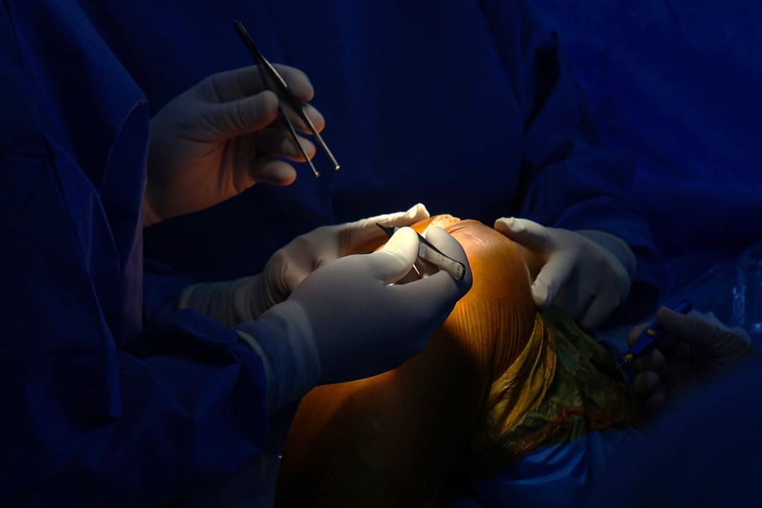 SC amplia cirurgias ortopédicas e habilita hospital no Oeste