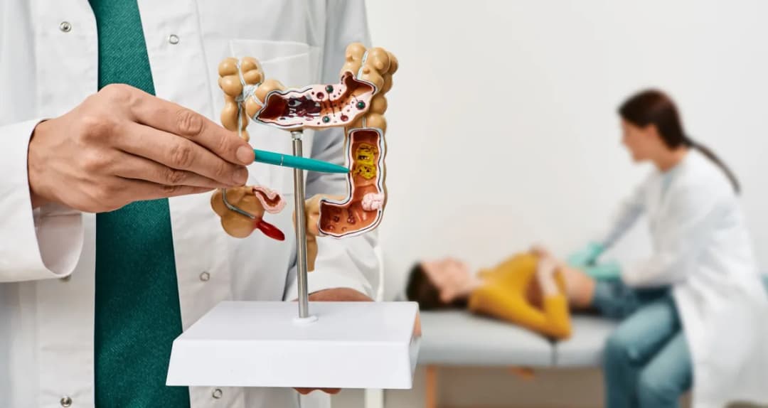 Brasileiros reconhecem sinais do câncer colorretal, mas 40% adiam procura por médico