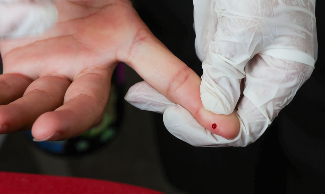 Brasil atinge meta internacional para eliminar transmissão da hepatite B de mãe para filho
