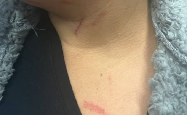 Mulher teve ferimentos pelo corpo (Foto: Polícia Militar)