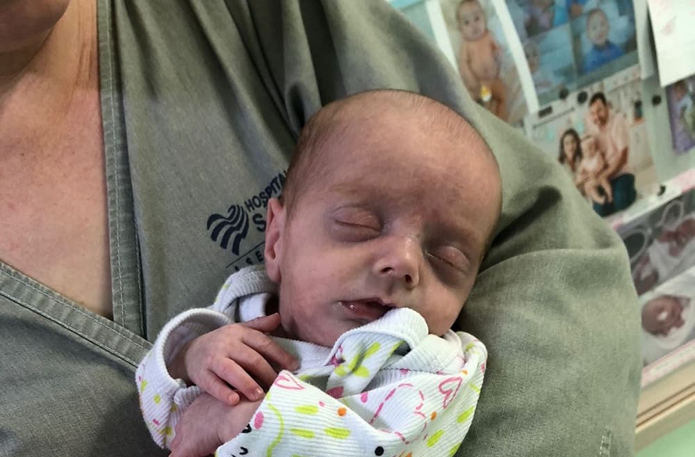Bebê prematura de Iporã do Oeste recebe alta da UTI