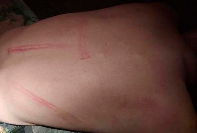 Homem foi atingido por pedaço de madeira (Foto: Campoere.com)
