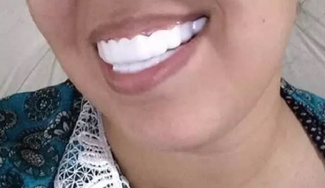 Dentes pela internet são uma das alternativas dos consumidores (Foto: Redes Sociais)