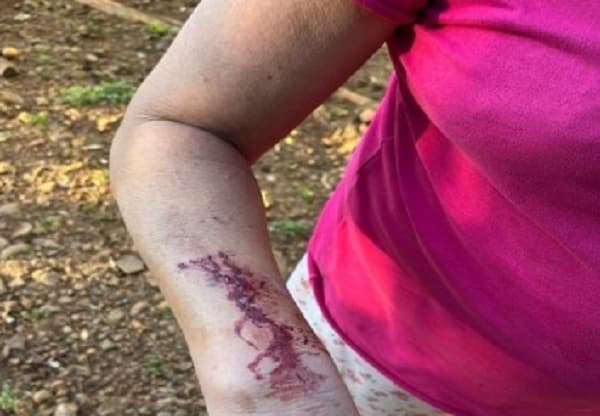 Mulher apresentava hematomas pelo corpo (Foto: Polícia Militar)
