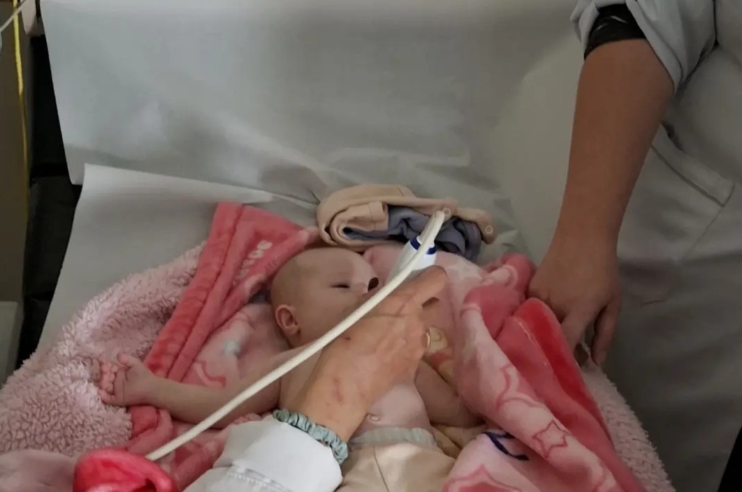 Doações podem ajudar bebê a se preparar para cirurgia cardíaca